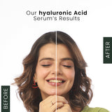 Hyaluronic Acid 30ML